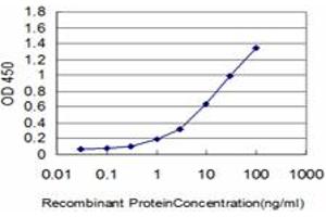 Detection limit for recombinant GST tagged IRAK2 is approximately 0. (IRAK2 antibody  (AA 111-210))