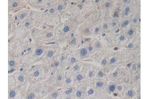 Detection of BMP15 in Human Liver Tissue using Polyclonal Antibody to Bone Morphogenetic Protein 15 (BMP15)