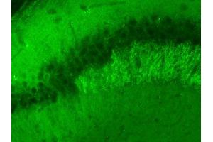 Indirect immunolabeling of PFA fixed mouse hippocampus sections (dilution 1 : 500) (VAMP2 antibody  (AA 2-17))