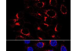 Immunofluorescence analysis of HeLa cells using USO1 Polyclonal Antibody at dilution of 1:200 (60x lens). (USO1 antibody)