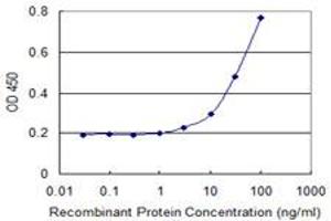 Detection limit for recombinant GST tagged AKR1B1 is 1 ng/ml as a capture antibody. (AKR1B1 antibody  (AA 1-316))