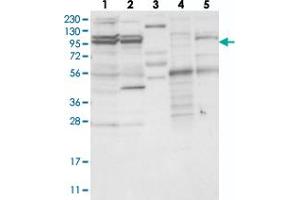 Western blot analysis of Lane 1: RT-4, Lane 2: U-251 MG, Lane 3: Human Plasma, Lane 4: Liver, Lane 5: Tonsil with TBC1D5 polyclonal antibody .