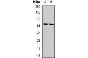 Western blot analysis of LIPI expression in Jurkat (A), HepG2 (B) whole cell lysates. (Lipase I antibody)