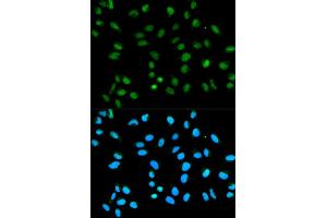 Immunofluorescence analysis of HeLa cells using HNRNPA2B1 antibody (ABIN5970508).