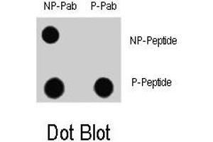 Dot blot analysis of MAP1LC3A (phospho S12) polyclonal antibody  and Nonphospho-MAP1LC3 antibody on nitrocellulose membrane. (MAP1LC3A antibody  (pSer12))