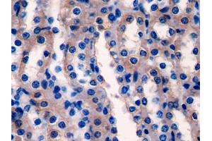 DAB staining on IHC-P; Samples: Rat Kidney Tissue (Ladinin 1 antibody  (AA 1-140))
