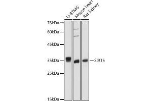 Western blot analysis of extracts of various cell lines, using SIRT5 antibody (ABIN6129331, ABIN6147798, ABIN6147799 and ABIN6221468) at 1:1000 dilution. (SIRT5 antibody  (AA 1-310))