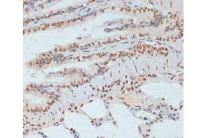 Immunohistochemistry of paraffin-embedded Rat lung using Phospho-p53(S33) Polyclonal Antibody at dilution of 1:100 (40x lens). (p53 antibody  (pSer33))