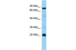 WB Suggested Anti-MED22 Antibody Titration: 1. (MED22 antibody  (Middle Region))