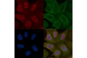 SENP2 Mouse Monoclonal Antibody staining Hela cells by IF/ICC. (SENP2 antibody)