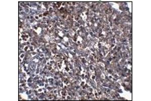 Immunohistochemistry (IHC) image for anti-ORAI Calcium Release-Activated Calcium Modulator 1 (ORAI1) (C-Term) antibody (ABIN492546) (ORAI1 antibody  (C-Term))