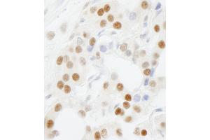 Immunohistochemistry (IHC) image for anti-General Transcription Factor IIIC, Polypeptide 5 (GTF3C5) (AA 469-519) antibody (ABIN7448588) (GTF3C5 antibody  (AA 469-519))