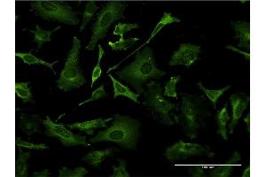 Immunofluorescence of monoclonal antibody to TAP1 on HeLa cell. (TAP1 antibody  (AA 241-350))