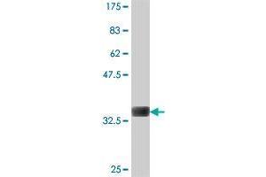 Western Blot detection against Immunogen (37 KDa) . (WDR19 antibody  (AA 1-99))