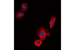 Immunofluorescent analysis of EGFR staining in Jurkat cells. (EGFR antibody  (C-Term))