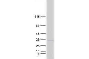 Validation with Western Blot