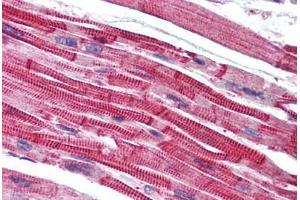 Human Heart (formalin-fixed, paraffin-embedded) stained with LPAR3 antibody ABIN768695 at 5 ug/ml followed by biotinylated goat anti-rabbit IgG secondary antibody ABIN481713, alkaline phosphatase-streptavidin and chromogen. (LPAR3 antibody  (AA 1-12))
