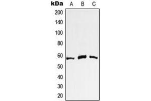Western blot analysis of c-Myc expression in A431 (A), Jurkat (B), HeLa (C) whole cell lysates.