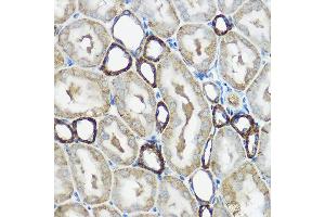 Immunohistochemistry of paraffin-embedded rat kidney using IP6K1 Rabbit pAb (ABIN6131922, ABIN6142500, ABIN6142501 and ABIN6215821) at dilution of 1:100 (40x lens). (IP6K1 antibody  (AA 1-220))