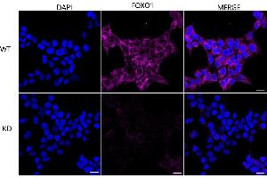anti-Forkhead Box O1 (FOXO1) antibody