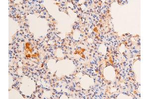 Immunohistochemistry (IHC) image for anti-Tumor Protein P53 (TP53) (pSer15) antibody (ABIN6256151)