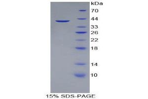 SDS-PAGE (SDS) image for Apolipoprotein A-II (APOA2) (AA 19-100) protein (His tag,GST tag) (ABIN2122423)