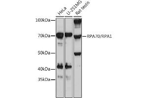 Western blot analysis of extracts of various cell lines, using RP/RP Rabbit mAb (ABIN7269915) at 1:1000 dilution. (RPA1 antibody)