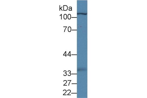 Myopalladin antibody  (AA 945-1320)