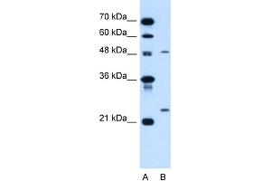 WB Suggested Anti-SMPD2 Antibody Titration:  1.