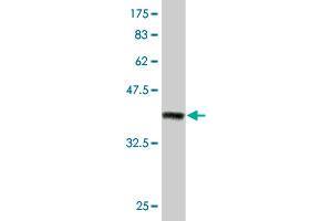Western Blot detection against Immunogen (37. (ZEB2 antibody  (AA 1115-1214))