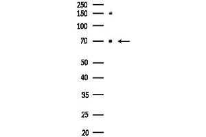anti-Histone Deacetylase 10 (HDAC10) antibody