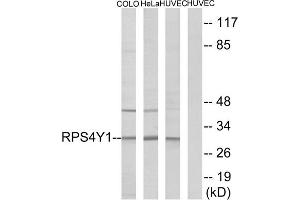 Western blot analysis of extracts from COLO cells, HeLa cells and HUVEC cells, using RPS4Y1 antibody. (RPS4Y1 antibody  (C-Term))