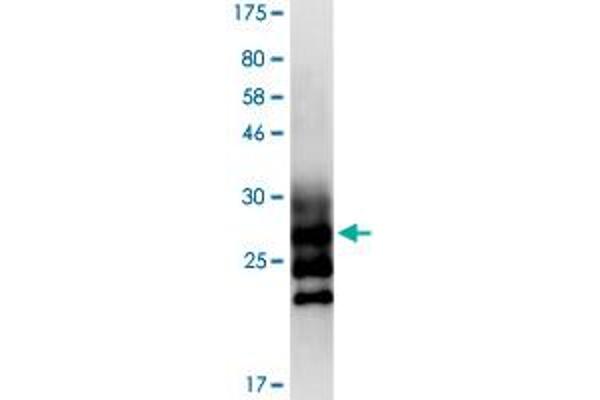 DcR2 Protein (AA 56-187) (His-DYKDDDDK-Strep II Tag)