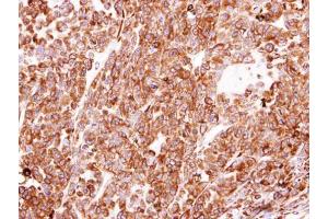 Immunohistochemistry (IHC) image for anti-Prolyl 4-Hydroxylase, beta Polypeptide (P4HB) antibody (ABIN2855054)