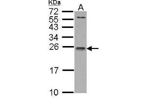 WB Image IL1 Receptor antagonist antibody detects IL1RN protein by Western blot analysis. (IL1RN antibody)