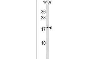 ATP5L2 Antibody (N-term) (ABIN1538885 and ABIN2850205) western blot analysis in WiDr cell line lysates (35 μg/lane). (ATP5L2 antibody  (N-Term))