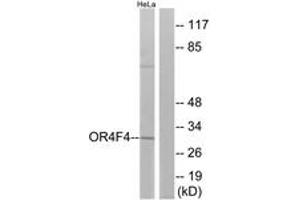 Western blot analysis of extracts from HeLa cells, using OR4F4 Antibody. (OR4F4 antibody  (AA 256-305))