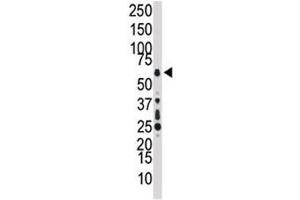 Western blot analysis of TAK1 antibody and HL-60 cell lysate.