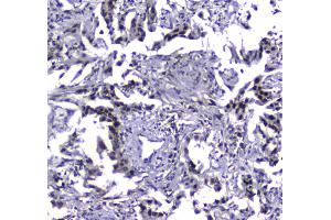 IHC analysis of MDC1 using anti-MDC1 antibody . (MDC1 antibody  (AA 534-626))