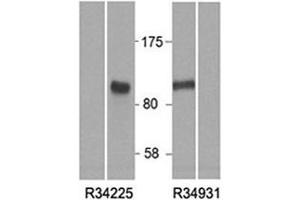 Western blot of HEK293 lysate overexpressing human HIC1 tested with HIC1 antibody at (0. (HIC1 antibody)