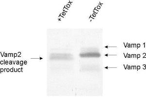dilution: 1 : 1000, sample: crude synaptosomal fraction of rat brain (P2) (VAMP1, 2, 3 (AA 1-81) antibody)