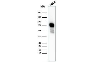 Western Blot Analysis of HeLa cell lysate using CD44 Rabbit Recombinant Monoclonal Antibody (HCAM/2875R). (Recombinant CD44 antibody)