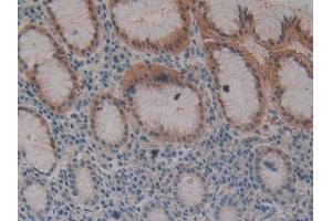DAB staining on IHC-P; Samples: Human Stomach Tissue (Fibrillin 3 antibody  (AA 403-667))