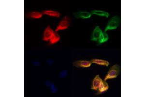 ABIN7094202 and ABIN7098248 staining Hela cells by IF/ICC. (ERGIC2 antibody  (C-Term))