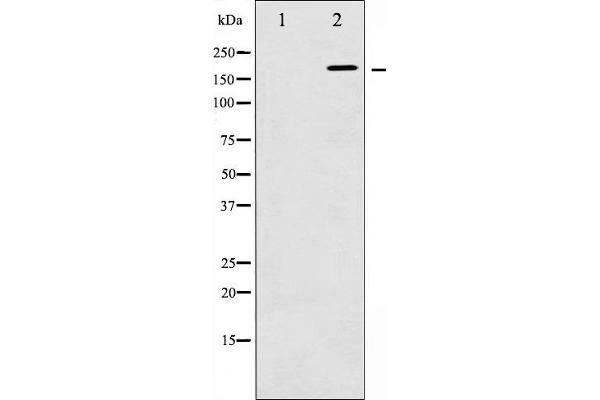 WNK1 antibody  (pThr60)