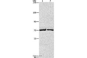 Western blot analysis of Hela and hepG2 cell, using CEL Polyclonal Antibody at dilution of 1:550 (Cholesterol Esterase antibody)