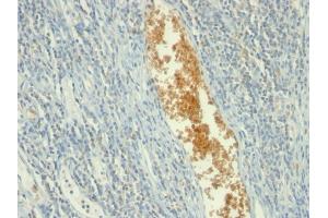 Formalin-fixed, paraffin-embedded human Tonsil stained with AMPD3 Mouse Monoclonal Antibody (AMPD3/901) (AMPD3 antibody)