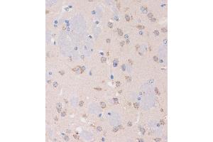 Immunohistochemistry of paraffin-embedded Mouse brain using STIM2 Rabbit pAb (ABIN7270611) at dilution of 1:100 (40x lens). (Stim2 antibody  (AA 60-180))
