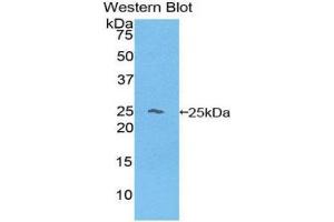 Western Blotting (WB) image for anti-Hemoglobin beta (HBB) (AA 1-145) antibody (ABIN1175990)