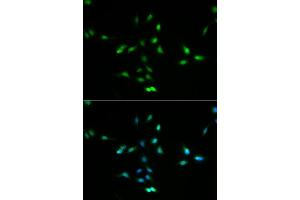 Immunofluorescence (IF) image for anti-Mdm2, p53 E3 Ubiquitin Protein Ligase Homolog (Mouse) (MDM2) (AA 130-230) antibody (ABIN3020951)